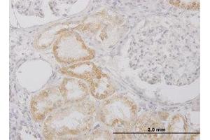 Image no. 2 for anti-Peptidase Inhibitor 15 (PI15) (AA 18-118) antibody (ABIN599240) (PI15 Antikörper  (AA 18-118))
