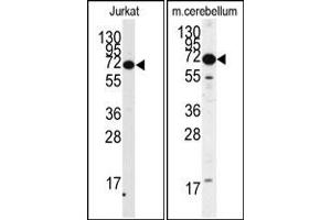 Image no. 1 for anti-Methyl CpG Binding Protein 2 (MECP2) antibody (ABIN357797) (MECP2 Antikörper)