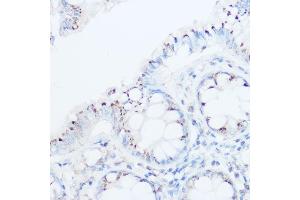 Immunohistochemistry of paraffin-embedded human colon using UBI Rabbit pAb (ABIN6134945, ABIN6149844, ABIN6149847 and ABIN6218504) at dilution of 1:500 (40x lens).