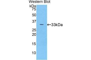 Western Blotting (WB) image for anti-Ceruloplasmin (Ferroxidase) (CP) (AA 789-1065) antibody (ABIN1077926) (Ceruloplasmin Antikörper  (AA 789-1065))