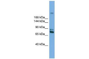 WB Suggested Anti-Dnmt1 Antibody Titration:  0. (DNMT1 Antikörper  (N-Term))