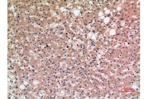 Immunohistochemical analysis of paraffin-embedded human-liver, antibody was diluted at 1:100.
