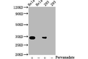 Western Blot Positive WB detected in:Hela whole cell lysate, 293 whole cell lysate(treated with Pervanadate or not) All lanes:Phospho-CDK2 antibody at 0. (Rekombinanter CDK2 Antikörper  (pTyr15))