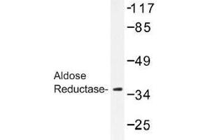 Image no. 1 for anti-Aldo-Keto Reductase Family 1, Member B1 (Aldose Reductase) (AKR1B1) antibody (ABIN317815) (AKR1B1 Antikörper)