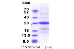 SDS-PAGE (SDS) image for B9 Protein Domain 1 (B9D1) (AA 1-204) protein (His tag) (ABIN5853866)