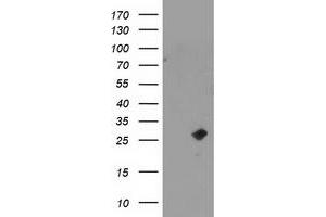 Western Blotting (WB) image for anti-Cyclin-Dependent Kinase Inhibitor 3 (CDKN3) antibody (ABIN1497459)
