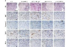 In vivo antitumor effect of miRNA-siRNA combination. (PLK1 Antikörper  (AA 201-300))