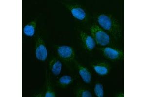IF analysis of OFD1 using anti-OFD1 antibody (ABIN7602739). (OFD1 Antikörper  (C-Term))