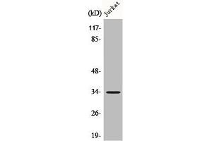 Western Blot analysis of Jurkat cells using C/EBP ε Polyclonal Antibody (CEBPE Antikörper)