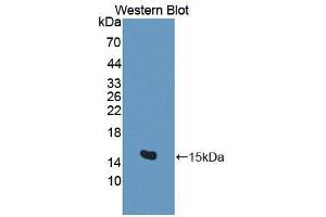 Western blot analysis of the recombinant protein. (BAMBI Antikörper  (AA 29-130))