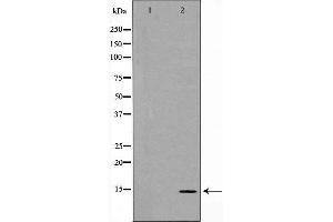 Western blot analysis of Hela cell lysate, using MYL9 Antibody. (MYL9 Antikörper  (N-Term))