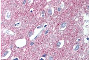 Immunohistochemistry (Formalin-fixed Paraffin-embedded Sections) (IHC (fp)) image for anti-Solute Carrier Family 17 (Vesicular Glutamate Transporter), Member 7 (SLC17A7) (AA 501-514) antibody (ABIN462523)