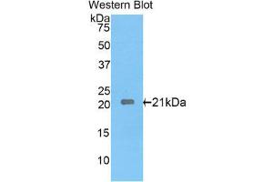 Western Blotting (WB) image for anti-Interleukin 17 Receptor E (IL17RE) (AA 457-626) antibody (ABIN1859366) (IL17RE Antikörper  (AA 457-626))