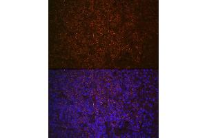 Immunofluorescence analysis of human spleen using SHIP11 Rabbit mAb (ABIN7267882) at dilution of 1:100 (40x lens). (INPP5D Antikörper)