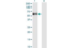 Western Blot analysis of GOLM1 expression in transfected 293T cell line by GOLPH2 monoclonal antibody (M04), clone 3B10.