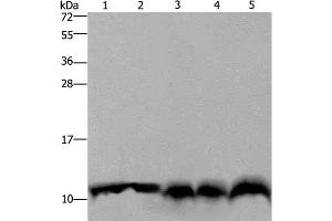 Western Blot analysis of Mouse pancreas tissue, Hela cell and Mouse liver tissue, A549 and 293T cell using UBB Polyclonal Antibody at dilution of 1:500 (Ubiquitin B Antikörper)