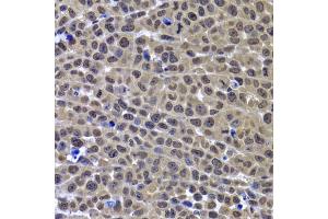 Immunohistochemistry of paraffin-embedded mouse cancer using GPS1 antibody. (GPS1 Antikörper)