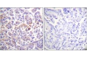 Immunohistochemistry (IHC) image for anti-V-Raf-1 Murine Leukemia Viral Oncogene Homolog 1 (RAF1) (AA 271-320) antibody (ABIN2888728) (RAF1 Antikörper  (AA 271-320))