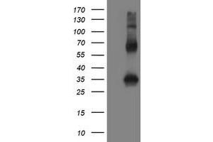 Image no. 2 for anti-Snail Family Zinc Finger 2 (SNAI2) antibody (ABIN1500979) (SLUG Antikörper)