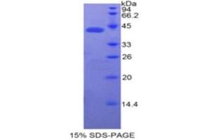 SDS-PAGE (SDS) image for Bactericidal/Permeability Increasing Protein (BPI) (AA 320-456) protein (His tag,GST tag) (ABIN1878302)