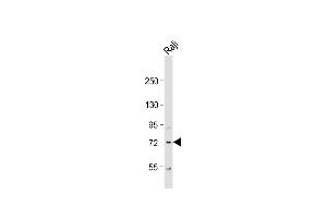 Anti-KLHL6 Antibody (C-term) at 1:1000 dilution + Raji whole cell lysate Lysates/proteins at 20 μg per lane. (KLHL6 Antikörper  (C-Term))