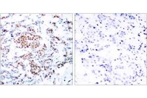 Immunohistochemistry (IHC) image for anti-Signal Transducer and Activator of Transcription 5A (STAT5A) (AA 666-715) antibody (ABIN2889069) (STAT5A Antikörper  (AA 666-715))
