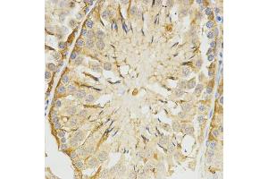 Immunohistochemistry of paraffin-embedded rat testis using TPM2 antibody (ABIN5971583) at dilution of 1/200 (40x lens). (TPM2 Antikörper)