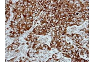 IHC-P Image Immunohistochemical analysis of paraffin-embedded H661 xenograft, using PPP3CB, antibody at 1:500 dilution. (PPP3CB Antikörper  (Center))