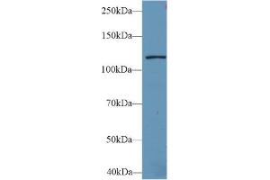 Western Blot; Sample: Mouse Liver lysate; Primary Ab: 2µg/ml Rabbit Anti-Human LARS Antibody Second Ab: 0. (LARS Antikörper  (AA 260-509))