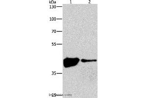 Western blot analysis of 293T and human fetal brain tissue, using MAPK11  Polyclonal Antibody at dilution of 1:200 (MAPK11 Antikörper)