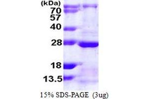 SDS-PAGE (SDS) image for RAB13, Member RAS Oncogene Family (RAB13) (AA 1-200) protein (His tag) (ABIN667931) (RAB13 Protein (AA 1-200) (His tag))