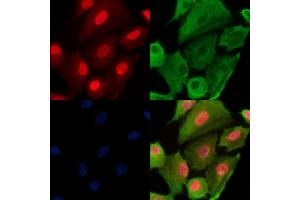 Phospho-RAD18 (Ser99) Antibody staining A549 cells(H2O2 treatment) by IF/ICC. (RAD18 Antikörper  (pSer99))