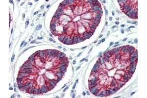 Human Colon (formalin-fixed, paraffin-embedded) stained with CLDN1at 10 µg/ml followed by biotinylated goat anti-rabbit IgG secondary antibody, alkaline phosphatase-streptavidin and chromogen. (Claudin 1 Antikörper  (C-Term))