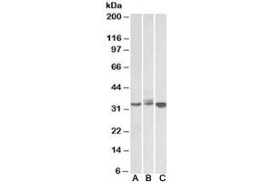 Western blot testing of Daudi (A), Jurkat (B) and K562 (C) lysates with LIVIN antibody at 0. (BIRC7 Antikörper)