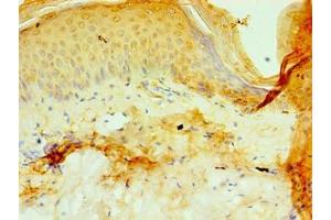 Immunohistochemistry of paraffin-embedded human skin tissue using ABIN7164787 at dilution of 1:100 (P4HA3 Antikörper  (AA 20-544))