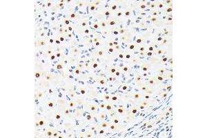 Immunohistochemistry of paraffin-embedded rat ovary using SUPT5H/SPT5 Rabbit mAb (ABIN7270878) at dilution of 1:100 (40x lens). (SUPT5H Antikörper)
