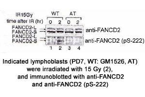 Image no. 1 for anti-Fanconi Anemia, Complementation Group D2 (FANCD2) (AA 217-226), (pSer222) antibody (ABIN363448) (FANCD2 Antikörper  (pSer222))