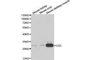 Western blot analysis of extracts of various cell lines, using CA3 antibody. (CA3 Antikörper)