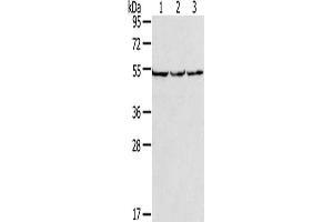 Gel: 8 % SDS-PAGE, Lysate: 40 μg, Lane 1-3: PC3 cells, hela cells, A549 cells, Primary antibody: ABIN7191485(MMP23B Antibody) at dilution 1/200, Secondary antibody: Goat anti rabbit IgG at 1/8000 dilution, Exposure time: 10 seconds (MMP23A Antikörper)