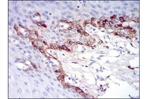 Immunohistochemical analysis of paraffin-embedded esophageal tissues using FTL mouse mAb with DAB staining. (FTL Antikörper  (full length))