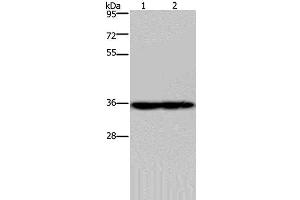 Western Blot analysis of Mouse heart and kidney tissue using NDUFA9 Polyclonal Antibody at dilution of 1:400 (NDUFA9 Antikörper)