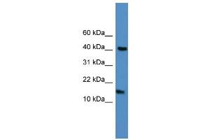 WB Suggested Anti-LCN1  Antibody Titration: 0.