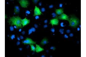 Anti-ARFGAP1 mouse monoclonal antibody (ABIN2454386) immunofluorescent staining of COS7 cells transiently transfected by pCMV6-ENTRY ARFGAP1 (RC206987). (ARFGAP1 Antikörper)