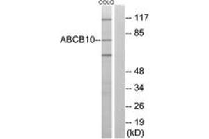 Western blot analysis of extracts from COLO cells, using ABCB10 Antibody. (ABCB10 Antikörper  (AA 441-490))