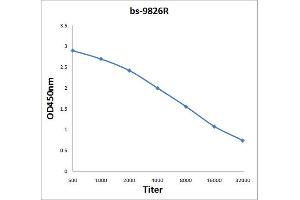 Antigen: 2 µg/100 µL  Primary: Antiserum, 1:500, 1:1000, 1:2000, 1:4000, 1:8000, 1:16000, 1:32000;  Secondary: HRP conjugated Rabbit Anti-Goat IgG at 1: 5000;  TMB staining Read the data in Microplate Reader by 450nm. (XXYLT1 Antikörper  (AA 120-165))