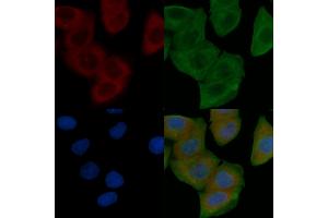 ABIN6259263 and ABIN6274611 staining Hela cells by IF/ICC. (TMEM30B Antikörper  (Internal Region))