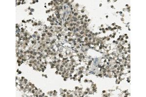 IHC analysis of REC8 using anti-REC8 antibody (ABIN7599473). (REC8 Antikörper  (AA 1-547))