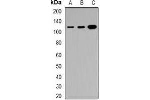 Western blot analysis of Tensin 3 expression in HeLa (A), DLD (B), H9C2 (C) whole cell lysates. (TNS3 Antikörper)