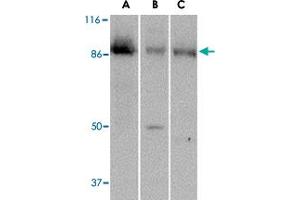 Western blot analysis of PTK7 in (A) human colon, (B) mouse kidney and (C) rat liver tissue lysate with PTK7 polyclonal antibody  at 1 ug/mL . (PTK7 Antikörper  (C-Term))
