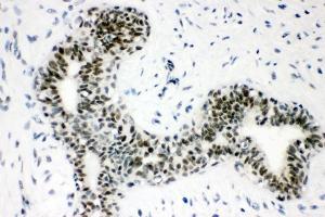 IHC analysis of Sumo 1/SUMO1 using anti-Sumo 1/SUMO1 antibody (ABIN7603002). (SUMO1 Antikörper  (Middle Region))